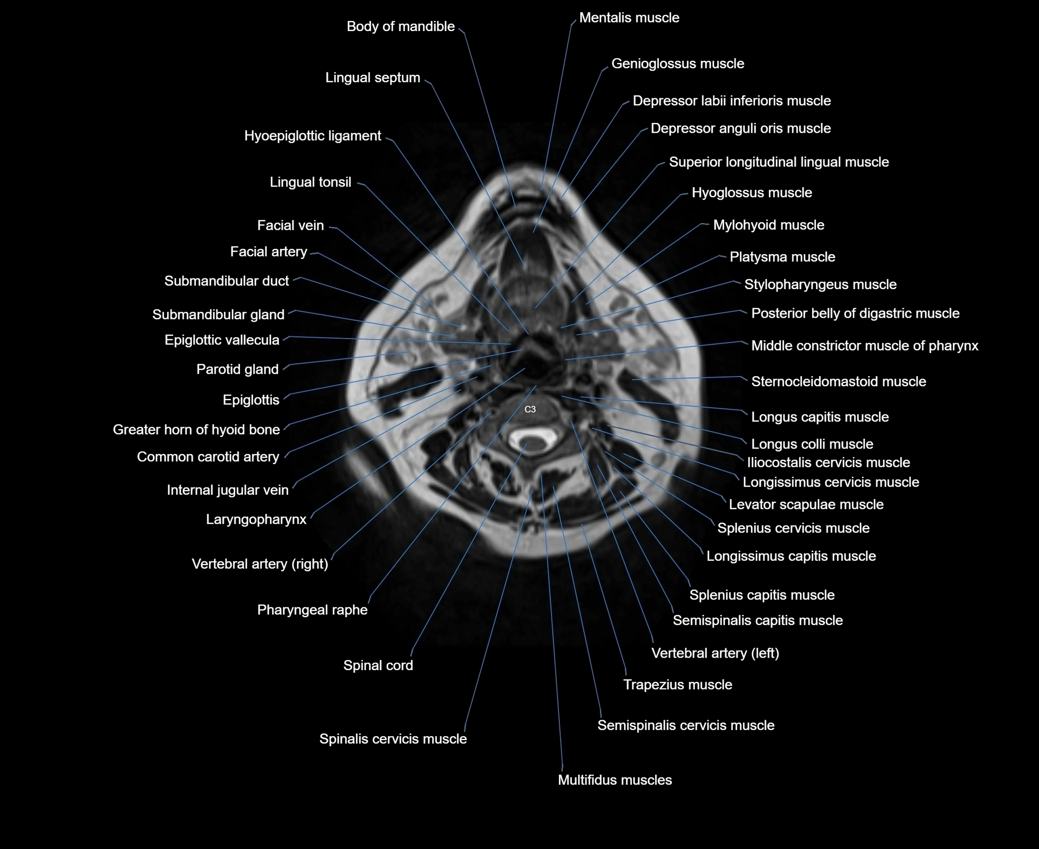 MRI Neck 3D labelled cross section anatomy axial 3t image-00001-00045.webp